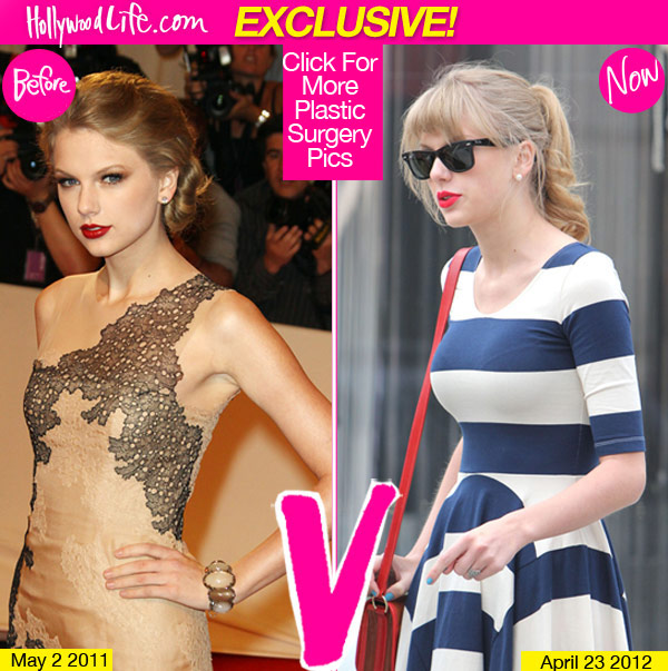 taylor-swift-breast-implants-before-after-pics120425183818.jpg